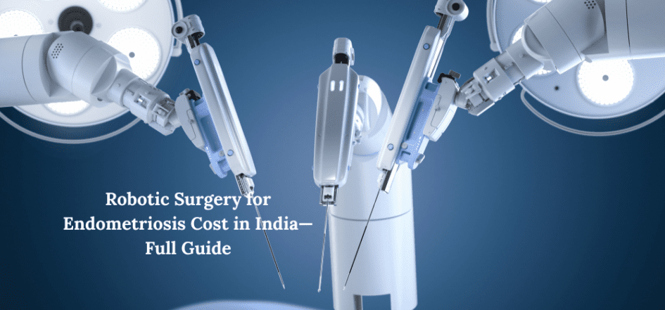 Robotic Surgery for Endometriosis Cost in India—Full Guide