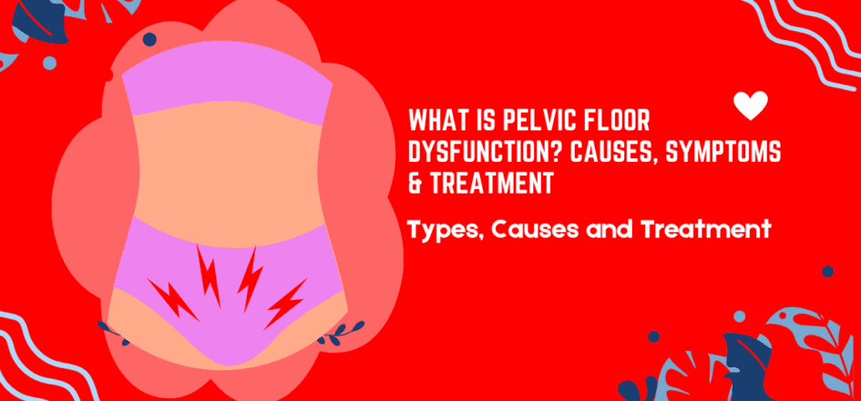What Is Pelvic Floor Dysfunction? Causes, Symptoms & Treatment