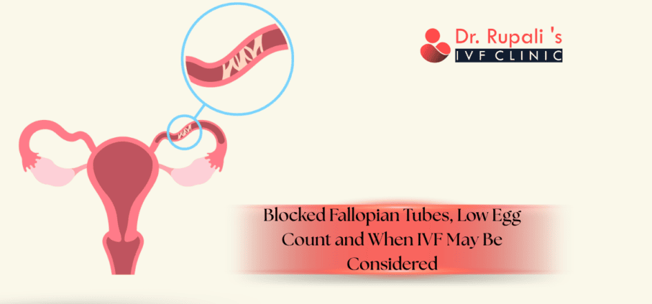 Blocked Fallopian Tubes, Low Egg Count and When IVF May Be Considered