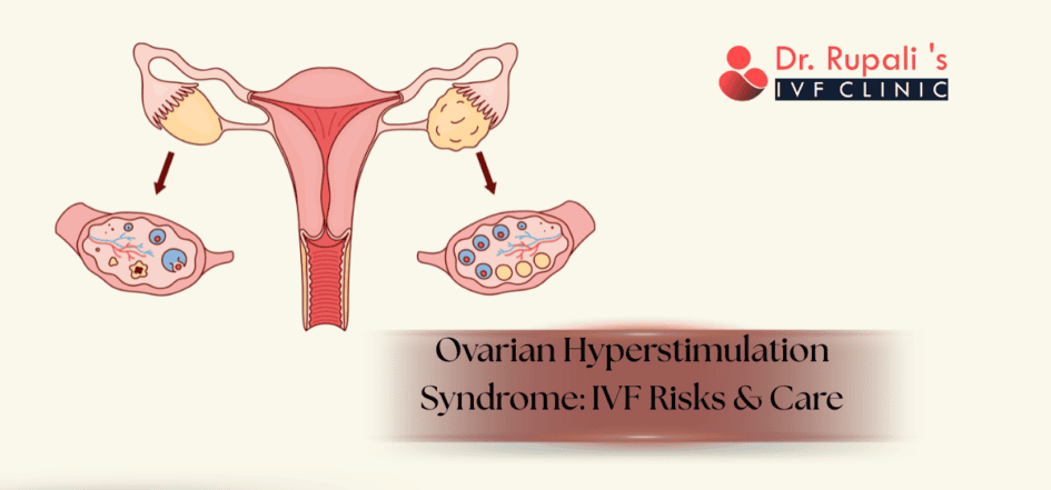 Ovarian Hyperstimulation Syndrome: IVF Risks & Care