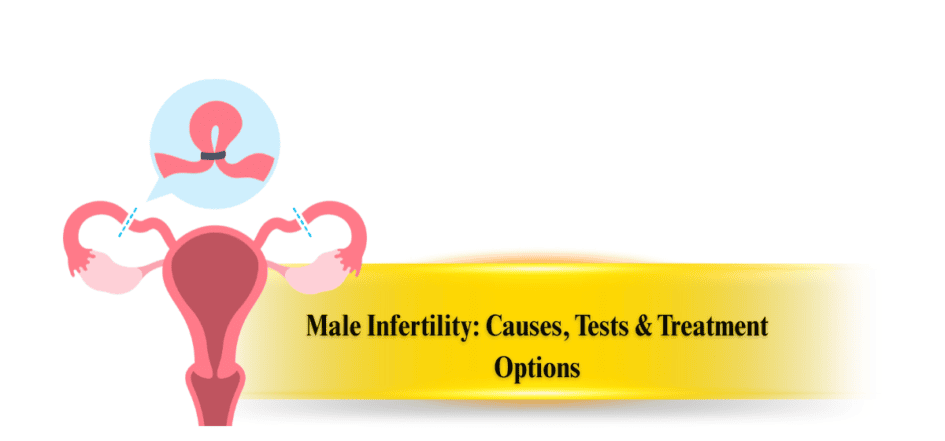Male Infertility Causes, Tests & Treatment Options