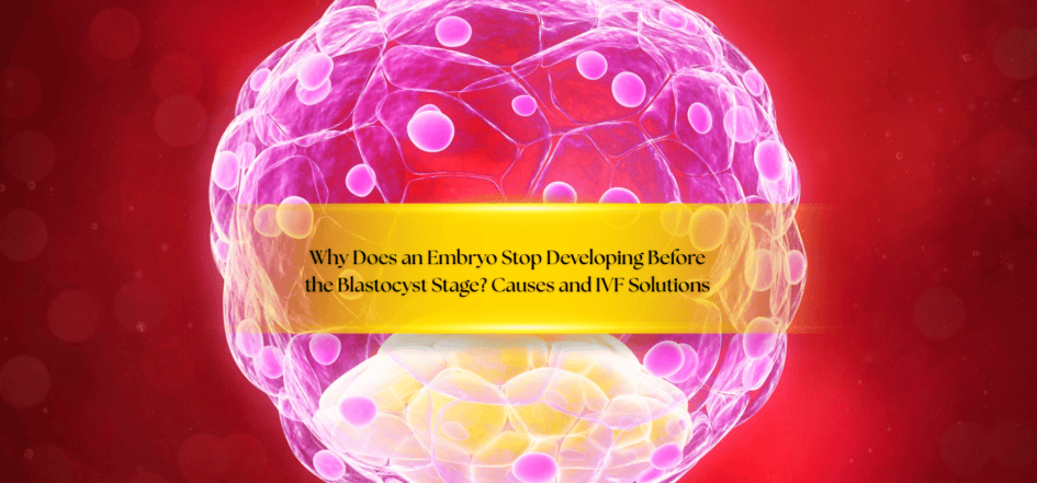 Why Does an Embryo Stop Developing Before the Blastocyst Stage? Causes and IVF Solutions